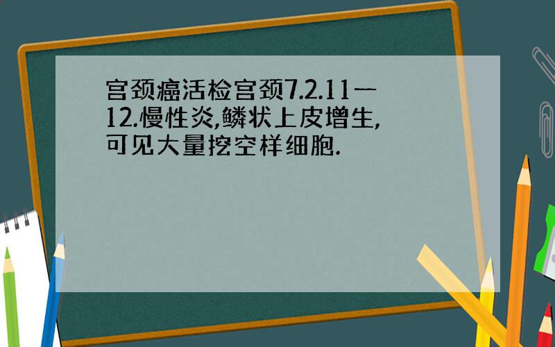 宫颈癌活检宫颈7.2.11一12.慢性炎,鳞状上皮增生,可见大量挖空样细胞.