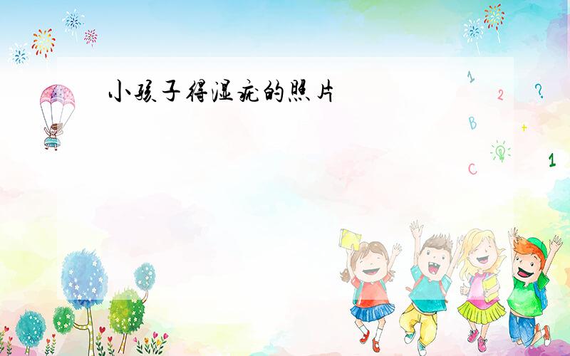 小孩子得湿疣的照片