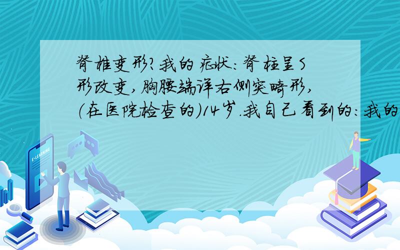 脊椎变形?我的症状：脊柱呈S形改变,胸腰端详右侧突畸形,（在医院检查的）14岁.我自己看到的：我的肩膀一边高一边低,腰部