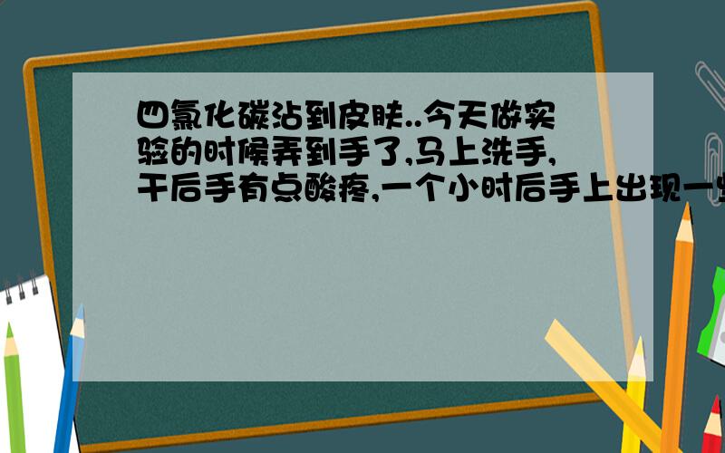 四氯化碳沾到皮肤..今天做实验的时候弄到手了,马上洗手,干后手有点酸疼,一个小时后手上出现一些咖啡色的黑点,现在没了,会