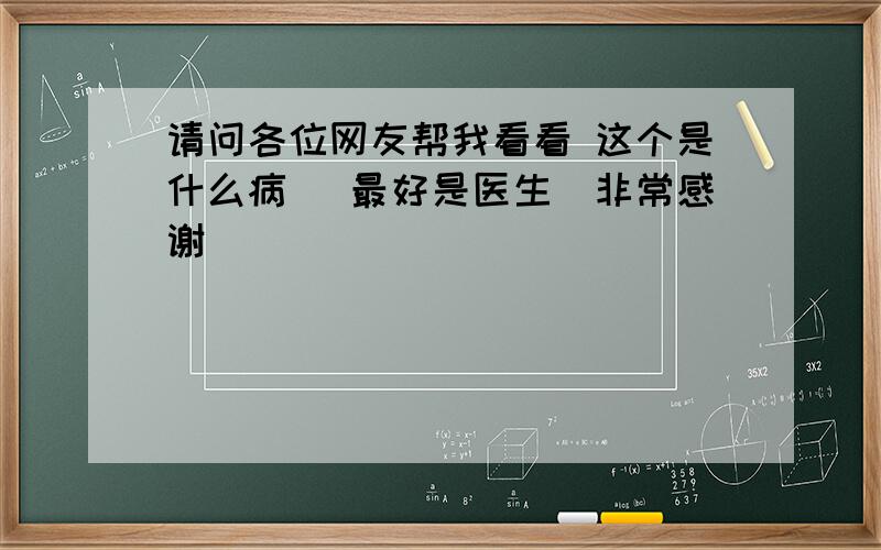 请问各位网友帮我看看 这个是什么病 （最好是医生）非常感谢