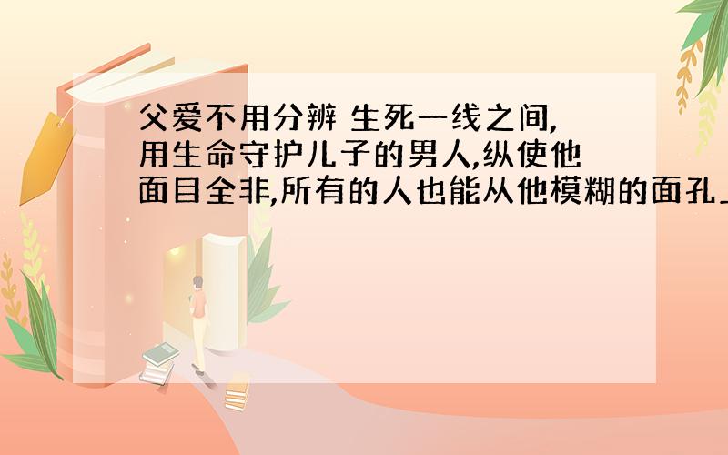 父爱不用分辨 生死一线之间,用生命守护儿子的男人,纵使他面目全非,所有的人也能从他模糊的面孔上看到两个清晰的大字——父爱