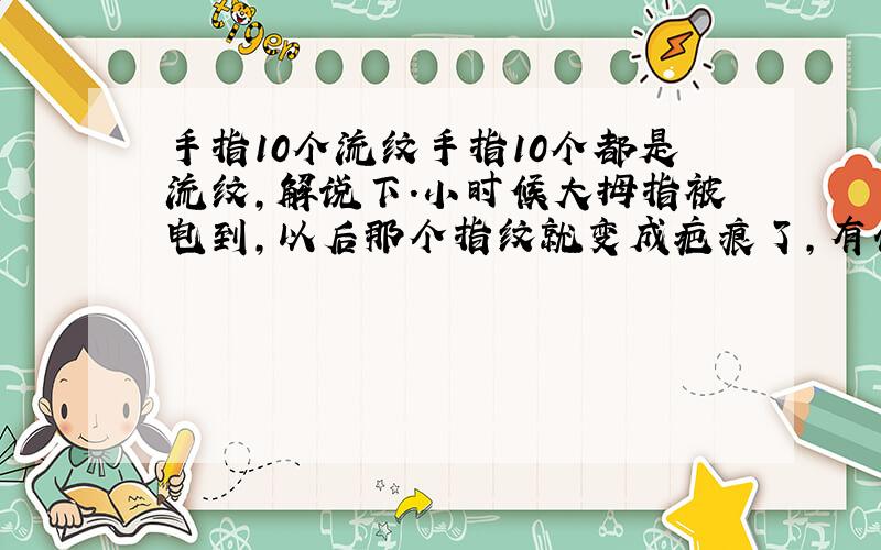 手指10个流纹手指10个都是流纹,解说下.小时候大拇指被电到,以后那个指纹就变成疤痕了,有什么影响?